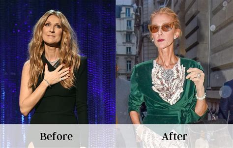 celine dion weight and height|celine dion weight loss cause.